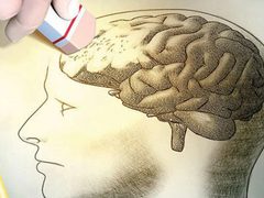 هل تعرف لماذا تخونك الذاكرة؟ دراسة تكشف دور خلايا الهيستامين