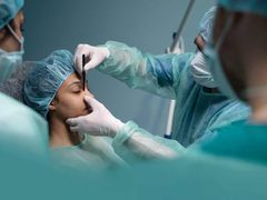 الجراحات التجميلية.. حاجة طبية أم هوس صنعته السوشال ميديا؟