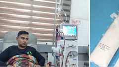 أبو سلمية: نقص مادة "البيكربونات" أجبرنا على تقليص جلسات غسيل الكلى في غزة