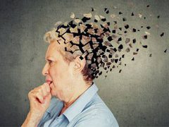 حالة نادرة: استعادة قدرات إدراكية لمريضة ألزهايمر بعد استخدام السيلوسايبين