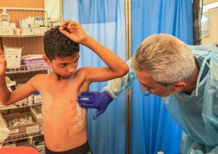 الأمم المتحدة تُحذر من تفشٍ واسع لـ "جدري الماء" في قطاع غزة
