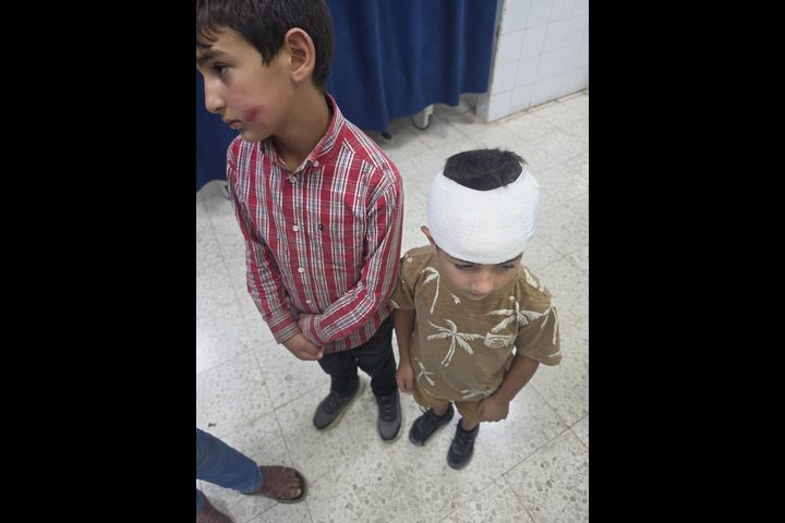 إصابة طفلين من اللبن الشرقية في اعتداء لمستوطنين شرق سلفيت