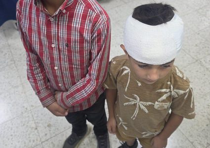 إصابة طفلين من اللبن الشرقية في اعتداء لمستوطنين شرق سلفيت