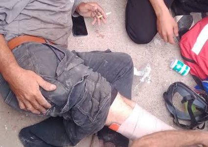 إصابة مواطن جراء اعتداء جنود الاحتلال عليه بالضرب في أوصرين